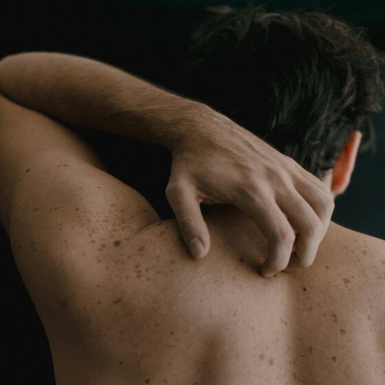 Man scratching skin on his back
