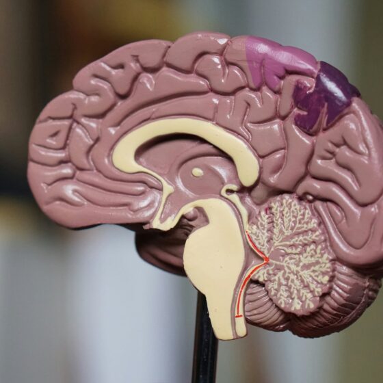 Model of a brain